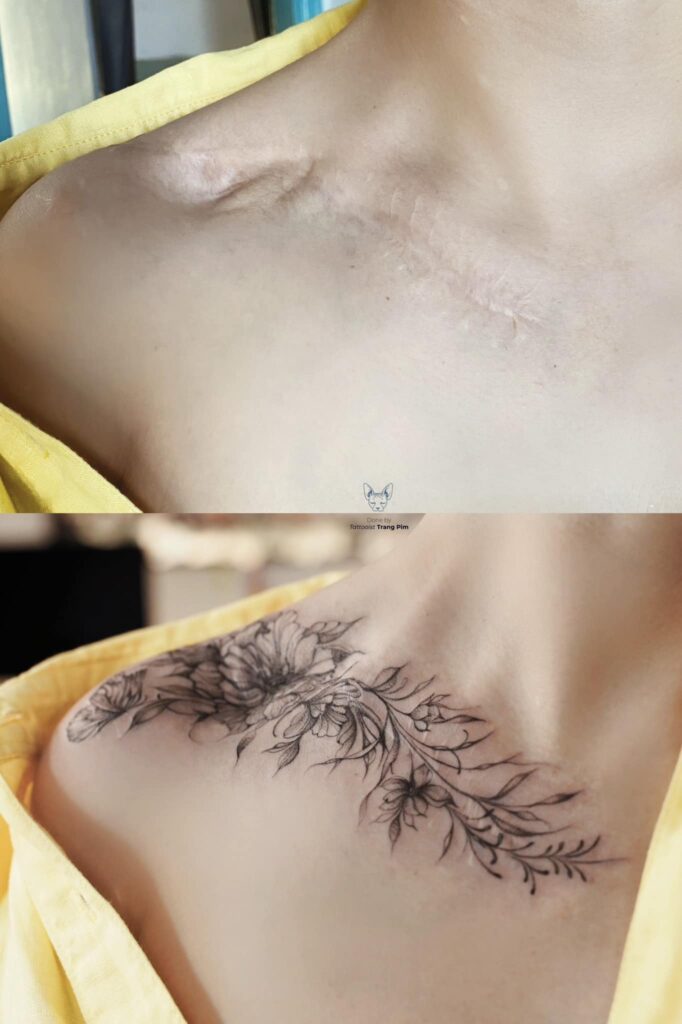 Tattoo cover scars
