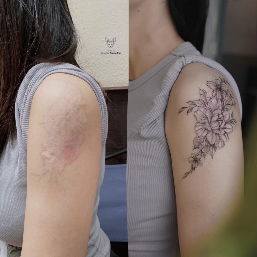 Wounds Healed With Tattoos