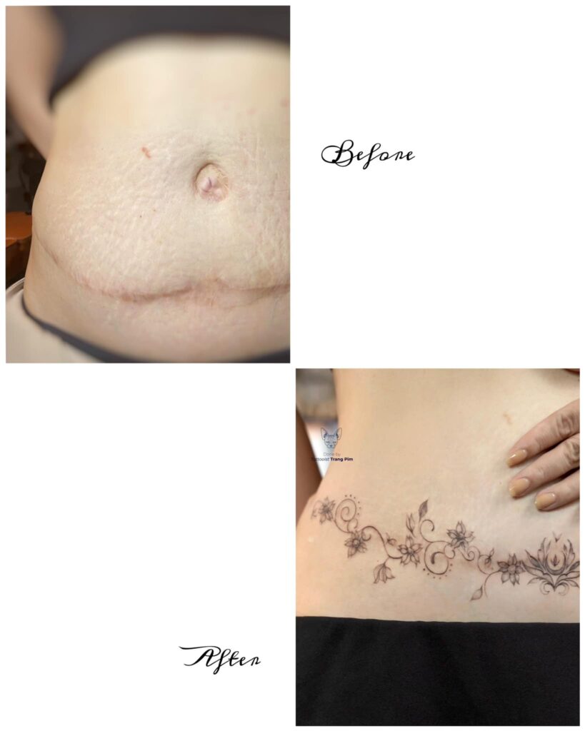 THE POWER TO HEAL DEFECTS FROM TATTOOS